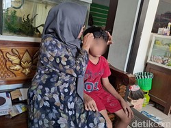 Pilu Saraf Retina Anak Polisi Jombang Rusak Kena Pecahan Gagang Sapu Teman