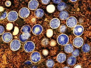 Ancaman Ngeri Virus Misterius Alaskapox, Pahami Gejala dan Pencegahannya Ancaman Ngeri Virus Misterius Alaskapox, Pahami Gejala dan Pencegahannya