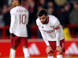 Ten Hag Sebut Bruno Fernandes Simpan Cedera Serius