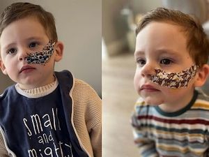 Pemicu Bocah Alami GTM Setahun Lebih, Berakhir Makan Pakai Selang