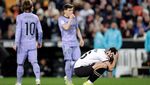 Ekspresi Pemain Valencia dan Real Madrid Lihat Diakhaby Patah Kaki