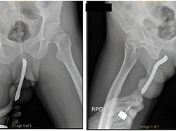 Bahaya Masukkan Benda ke Penis hingga Cara Sembuhkan Kelainan Seks
