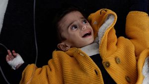 Pilu, Nasib Tragis Bocah Alami Gizi Buruk Akibat Bencana Kelaparan di Gaza