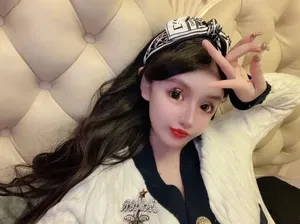 Viral Remaja Sudah 100 Kali Oplas Sejak Usia 13, Wajahnya Jadi Begini