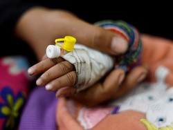 Cerita Dokter RS Bersalin di Gaza Kesulitan Selamatkan Bayi