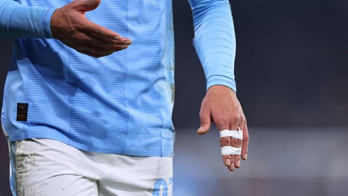 MANCHESTER, ENGLAND - MARCH 6: Matheus Nunes of Manchester City goes off with an injured finger during the UEFA Champions League 2023/24 round of 16 second leg match between Manchester City and F.C. Copenhagen at Etihad Stadium on March 6, 2024 in Manchester, England. (Photo by Robbie Jay Barratt - AMA/Getty Images)