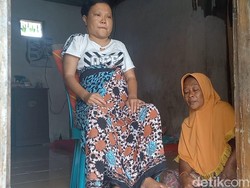 Polisi Periksa Bidan di Kasus Kepala Bayi Tertinggal dalam Rahim