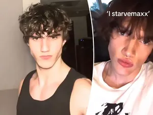 Berbahaya! Pola Diet Starvemaxxing Tanpa Makan Berhari-hari Berbahaya! Pola Diet Starvemaxxing Tanpa Makan Berhari-hari