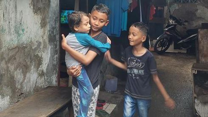 Kisah Pilu Dafa, Anak Kenek Truk Alami Kelainan Tulang hingga Jantung