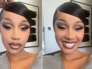 Kacau! Cardi B Mendadak Ompong Gegara Makan Bagel