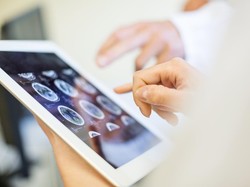 Dokter Imbau Jangan Kebanyakan Makan Ini Bila Tak Ingin Otak Cepat Rusak