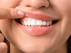 10 Cara Memutihkan Gigi Kuning Secara Alami, Bisa Pakai Siwak