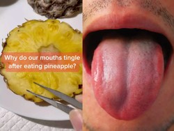 Lidah Terasa Digigit dan Kesemutan Usai Makan Nanas? Ternyata Ini Sebabnya