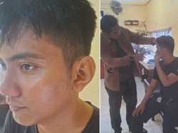 Penampakan Polisi Korban Pengeroyokan Pengantar Jenazah di Makassar