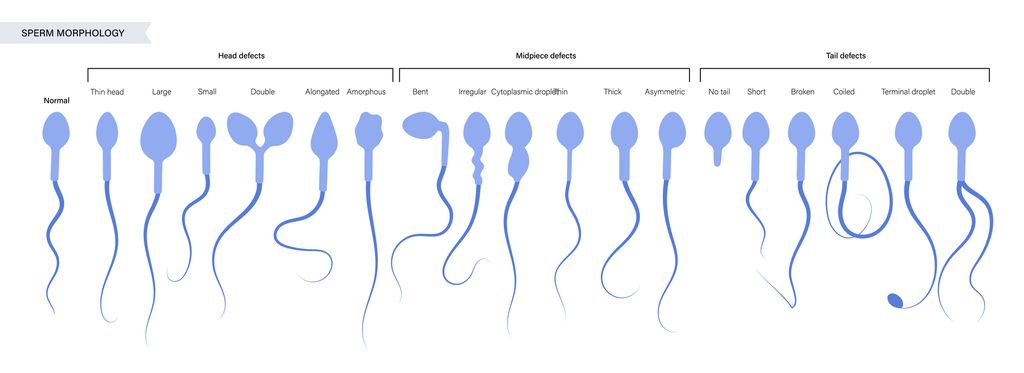 Sperm illustration