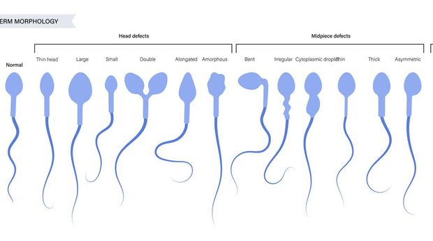 Ilustrasi Sperma