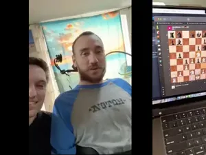 Penerima Tanam Chip Otak Mampu Gerakkan Kursor Pakai Pikiran