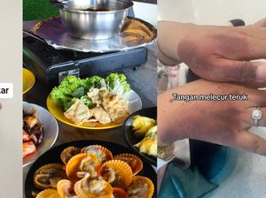 Kompor Steamboat Meledak, Satu Keluarga Ini Alami Luka Bakar