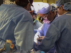 Ahli Bedah AS Berhasil Cangkok Ginjal Babi ke Manusia, Begini Kondisi Pasien