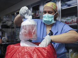 Orang Pertama Penerima Transplantasi Ginjal Babi Meninggal Dunia