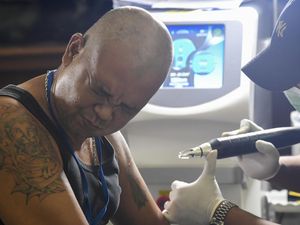 Raih Berkah Ramadan, Ratusan Orang Ikut Hapus Tato Gratis