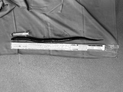 Kronologi Penemuan Belut Hidup di Perut Pasien Pria Vietnam, Begini Kejadiannya