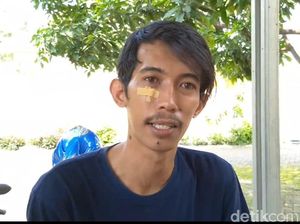 Pengakuan Pria Probolinggo yang Dikeroyok 5 Pemuda: Pelaku Mabuk Pengakuan Pria Probolinggo yang Dikeroyok 5 Pemuda: Pelaku Mabuk