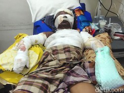 Paman-Keponakan di Probolinggo Luka Bakar-Jari Putus gegara Ledakan Petasan