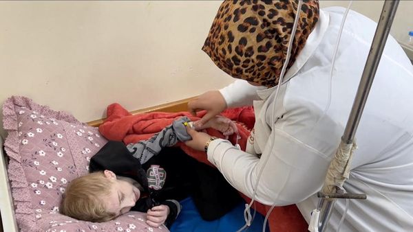 Potret Pilu Anak-anak di Gaza Menderita Kekurangan Gizi Parah