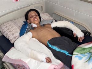 Detik-detik WHO Evakuasi 2 Anak Sakit Kritis di RS Kamal Adwan Gaza Detik-detik WHO Evakuasi 2 Anak Sakit Kritis di RS Kamal Adwan Gaza