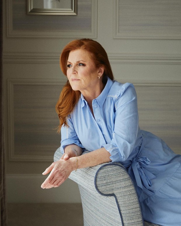 Sarah Ferguson divonis menderita kanker kulit