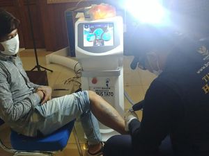 Melihat Antusiasme Peserta Hapus Tato Gratis di Bulan Ramadan