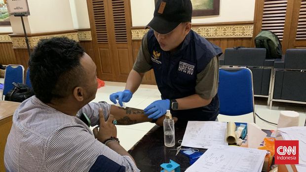 Layanan Pembersihan Tato Gratis oleh BAZIS BAZNAS DKI Jakarta di Kantor Walikota Jakarta Pusat, Selasa (26/3).