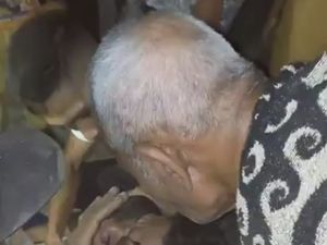 Ngeri, Bola Mata Pria di Dompu Pecah Setelah Terlempar dalam Tabrakan Motor