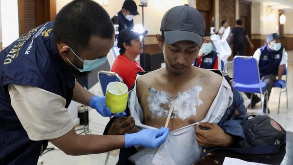 Warga Ramai-ramai Hapus Tato Gratis di Kantor Walikota Jakpus