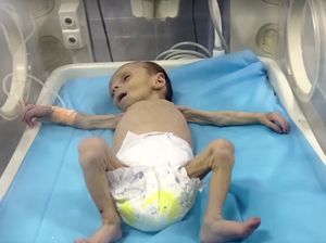 Pilu Bayi 2 Bulan di Gaza Berjuang Melawan Gizi Buruk