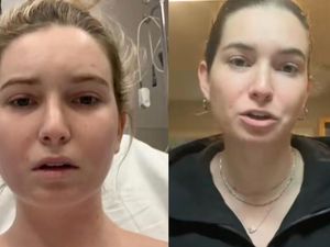 Makan Nasi dan Roti Bisa Bikin Meninggal Wanita Ini, Kok Bisa?