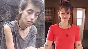 Potret Transformasi Orang-orang yang Berhasil Lepas dari Kecanduan