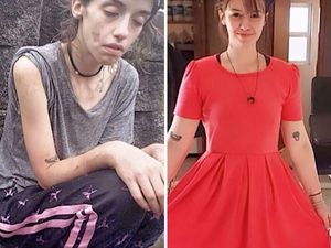 Potret Transformasi Orang-orang yang Berhasil Lepas dari Kecanduan