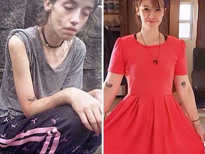 Potret Transformasi Orang-orang yang Berhasil Lepas dari Kecanduan