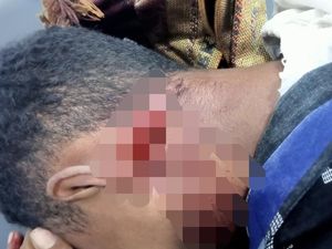 Pria di Alor Dibacok OTK, Leher Belakang Luka Dalam