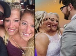 Wanita Kembar Siam Abby Hensel Sudah Nikah, Suaminya Veteran Angkatan Darat AS