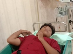 Begini Kondisi Riski Usai Matanya Disembur Bisa Kobra