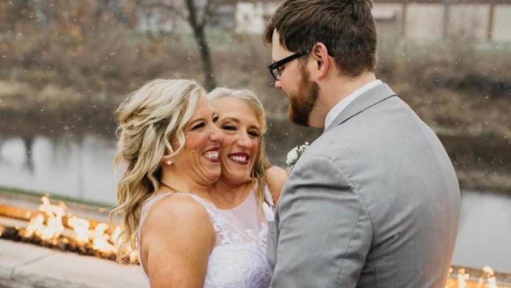 8 Foto Abby dan Brittany Kembar Dempet Dua Kepala yang Dinikahi Eks Tentara 8 Foto Abby dan Brittany Kembar Dempet Dua Kepala yang Dinikahi Eks Tentara