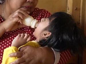 Rintihan Aida Anak Tukang Tahu Akibat Luka Bakar Tersiram Minyak