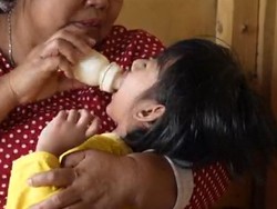 Rintihan Aida Anak Tukang Tahu Akibat Luka Bakar Tersiram Minyak