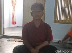 Pengakuan Riski yang Mata Kirinya Kena Semburan Bisa Kobra Pengakuan Riski yang Mata Kirinya Kena Semburan Bisa Kobra