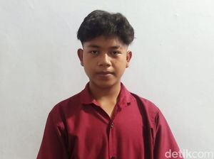 Kondisi Riski Remaja Pasuruan yang Matanya Kena Sembur Ular Kobra Kondisi Riski Remaja Pasuruan yang Matanya Kena Sembur Ular Kobra