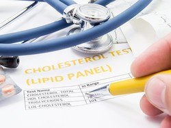 Viral di Medsos Usia Baru 21 Sudah Punya Kolesterol Tinggi, Inikah Pemicunya?