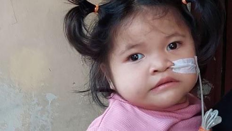 Kisah Pilu Reina Derita Kelainan Langka, Hilang Penglihatan hingga Memori